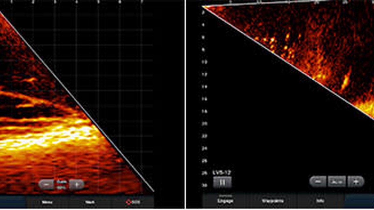 Trasduttore sonar Garmin 7